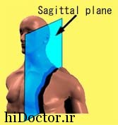 سطح سهمی (ساجيتال) sagittal