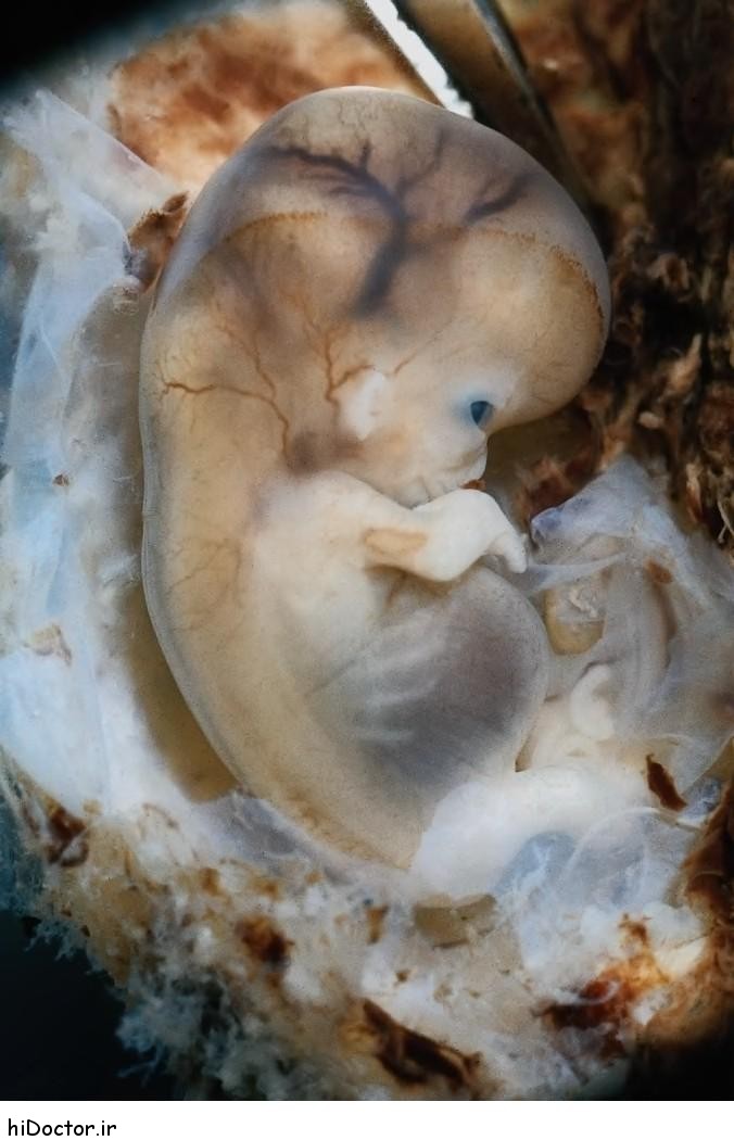 عکس های با کیفیت و واقعی از جنین انسان 3