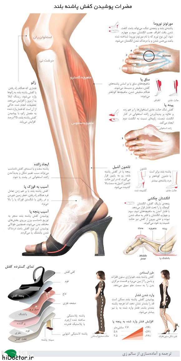 high-heels-infographic-salemzi-580p
