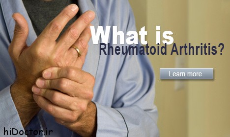 article-rheumatoid-arthritis