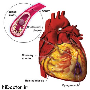 obesity_and_cardiovascular_disease