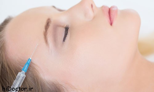 things-to-know-about-collagen-injections