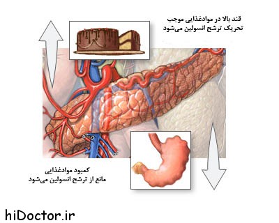 علل بوجود آمدن کتواسیدوز دیابتی 1