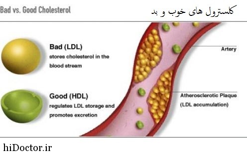 اچ دی ال HDL خوب است یا ال دی ال LDL؟