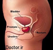 images16 درباره سرطان پروستات چه می دانید