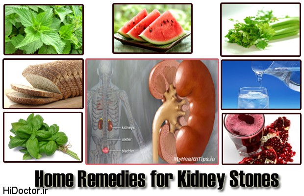 Rapid-Home-Remedies-For-Kidney-Stones