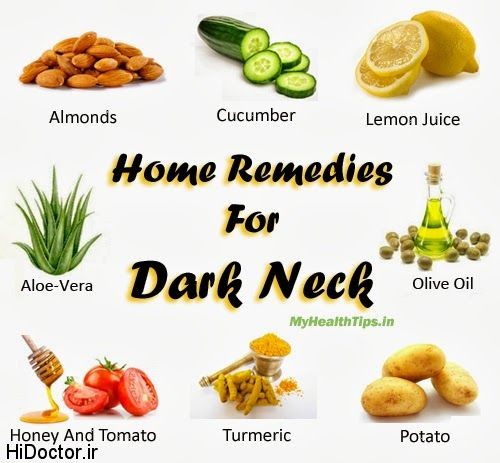 Some Of The Best Home Remedies To Get Rid Of Dark Neck داروهای خانگی برای رهایی از تیرگی گردن