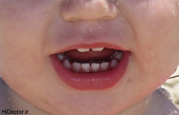 article-new-thumbnail-ehow-images-a05-4j-n0-baby-teeth-growth-800x800