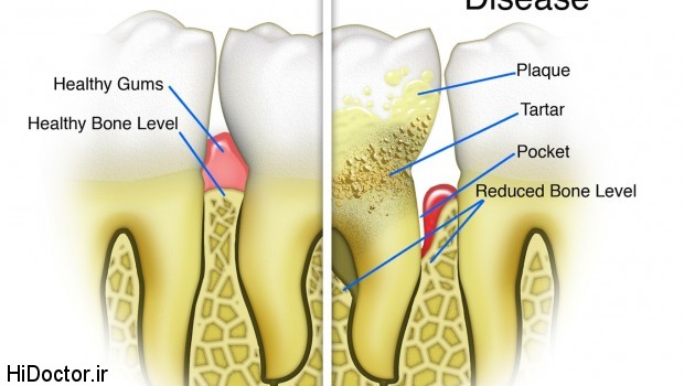 periodontal-tissue2-620x350