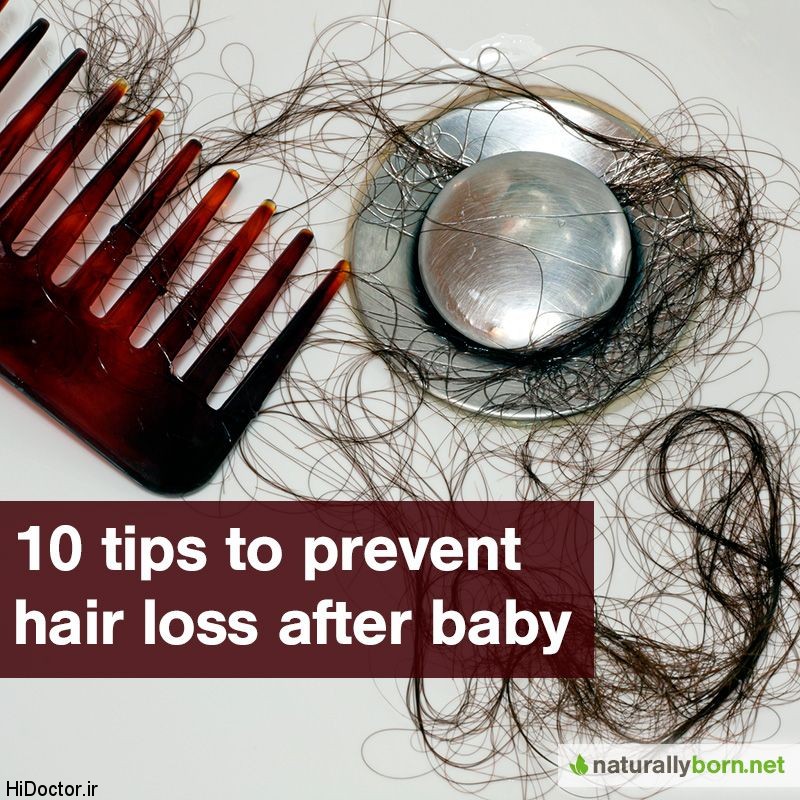 b2ap3_thumbnail_10-tips-to-prevent-hair-loss-after-pregnancy