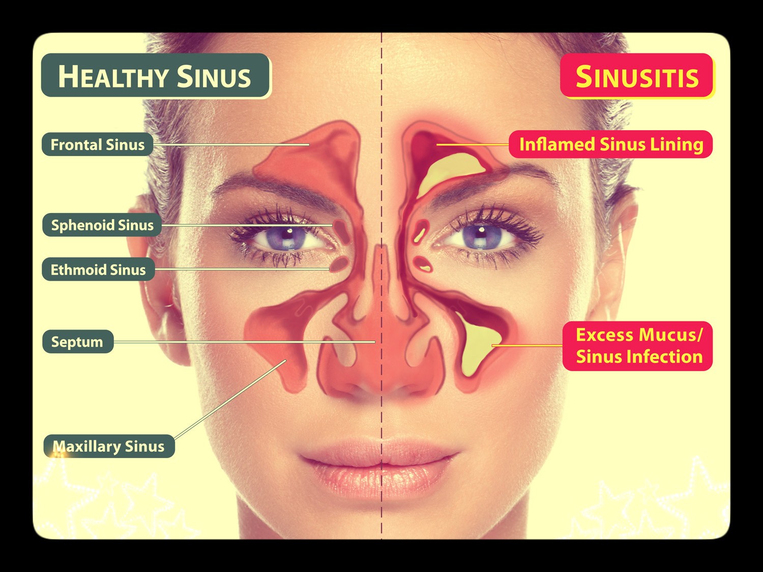 healthy-sinus-vs-sinusitis