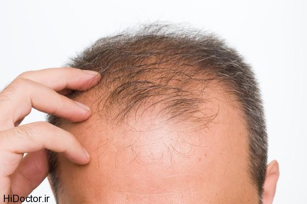 Gene-Therapy-Cure-For-Baldness