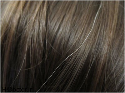 [عکس: Reducing-White-Hair.jpg]