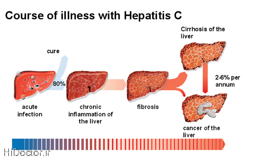 عوامل منتقل کننده ویروس هپاتیت c 1
