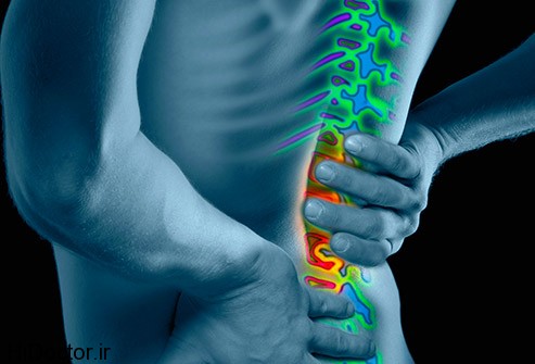 493x335_low_back_pain_overview_slideshow