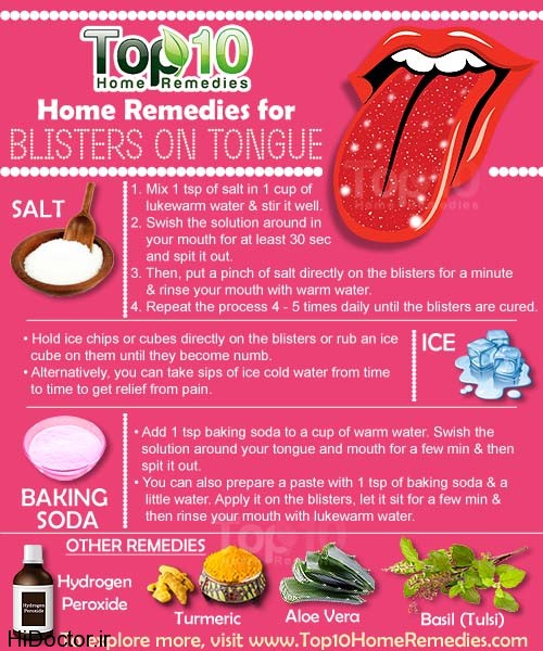 Blisters-on-tongue-wm-copy