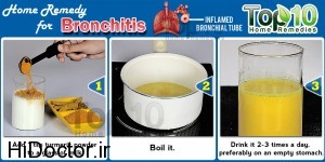 bronchitis-home-remedy-turmeric-300x150