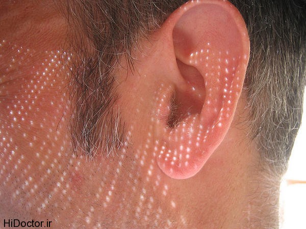 علت سرگیجه در گوش شماست 1