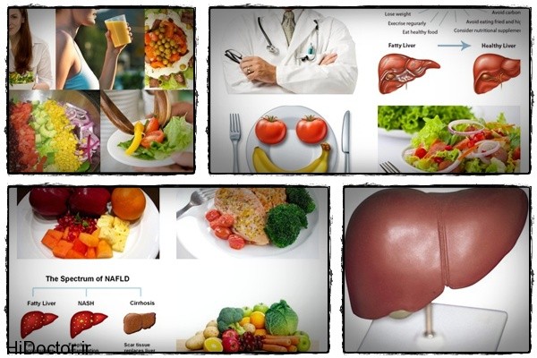 fatty-liver-diet-guide-review