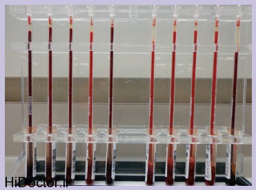 11fig3 مقدار رسوب گلبول قرمز با چه آزمایشی سنجیده می شود؟