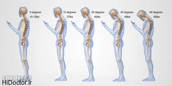 407164 179 تصاویری در مورد تاثیرات مخرب تبلت و گوشی همراه