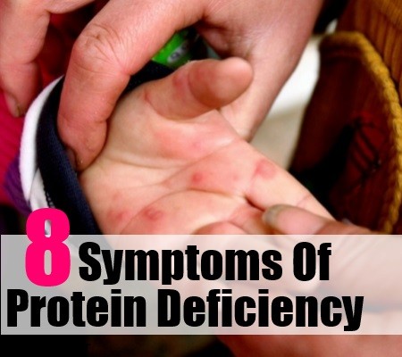 Protein-Deficiency