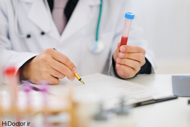 Closeup on hands of medical doctor holding blood sample and making notes