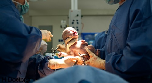 cesarean_section_baby