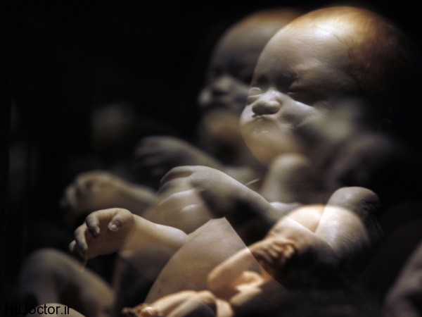 foetus مشکلات لگن در بزرگسالی منجر به نارس بودن کودک می شود
