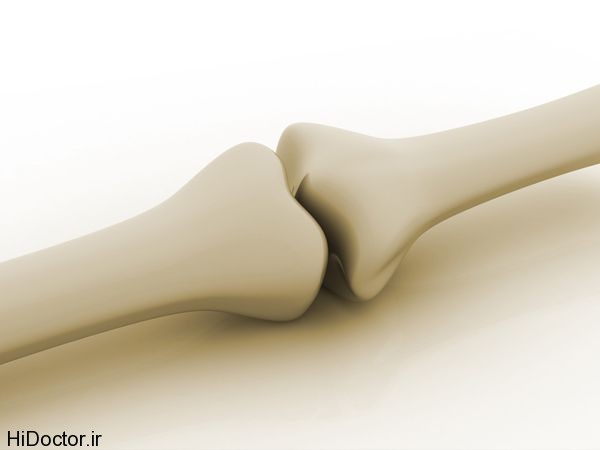 bone-health_600x450