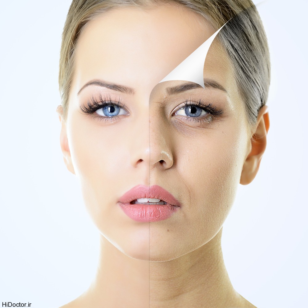 botox1 با پیر شدن انسان روی پوستش این تغییرات رخ میدهد