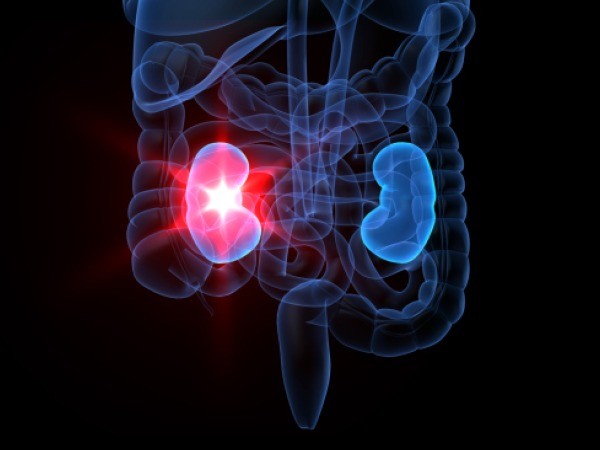 kidney1 در آزمایشگاه رنگ ادرار را چگونه بررسی میکنند؟