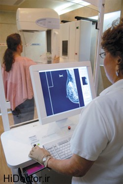 Mammography