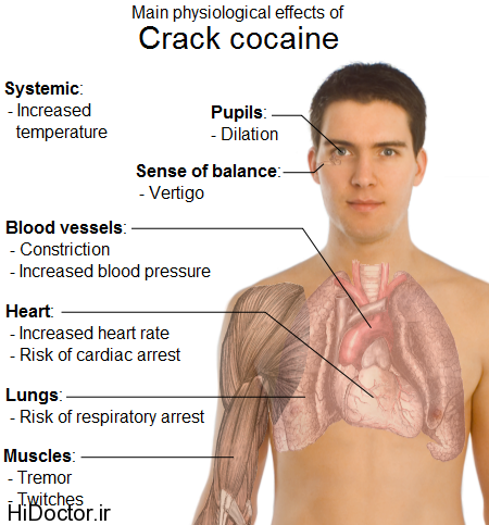 Physiological_effects_of_Crack_cocaine