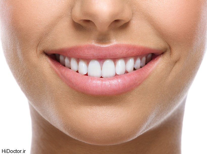 closeup of smile with white teeth