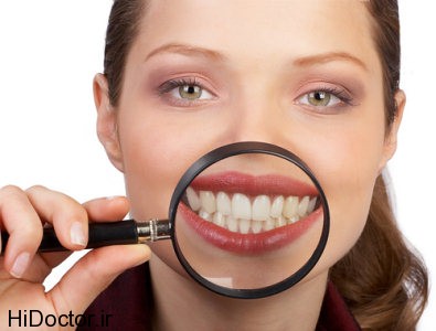 how-to-get-white-teeth