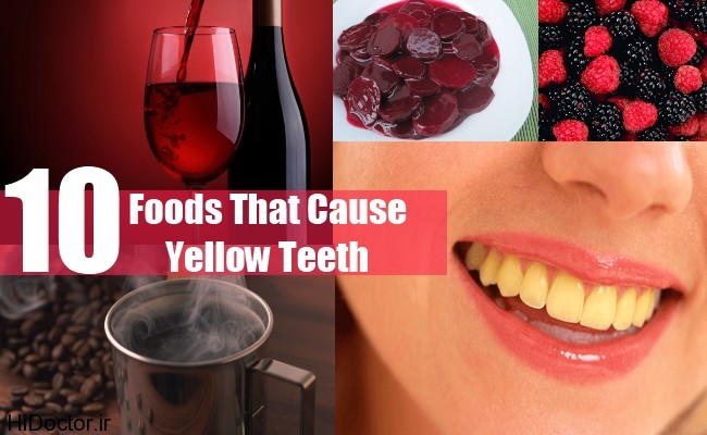 Foods-That-Cause-Yellow-Teeth