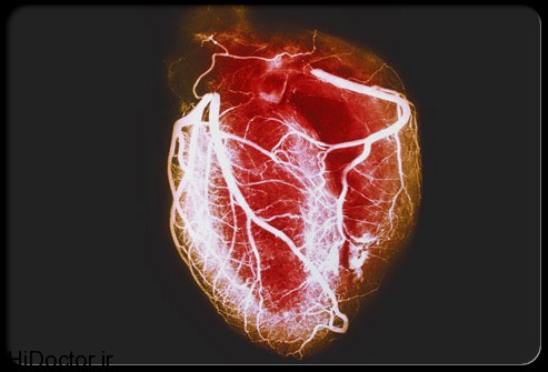 heart-disease-visual-guide-s1-arteriogram-of-healthy-heart