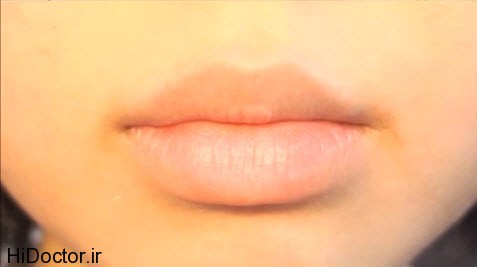 lips-dry
