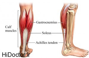 Achilles-tendon-photo.jpg