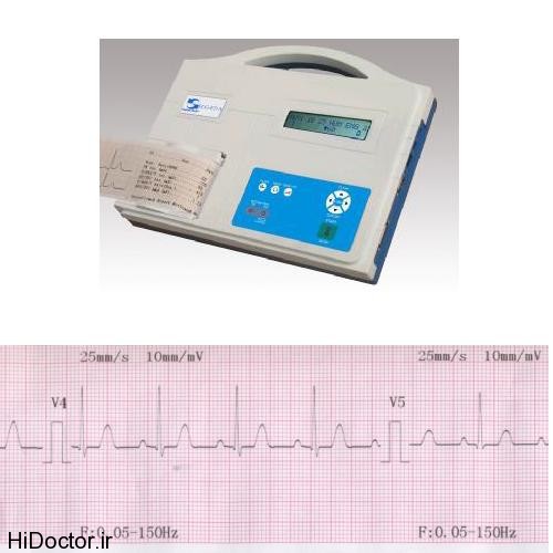 Single-channel electrocardiograph (9)