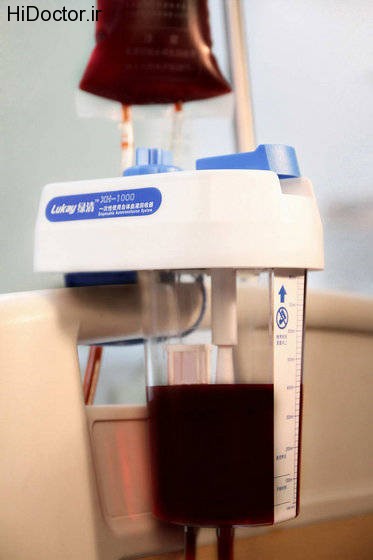 autotransfusion system (9)