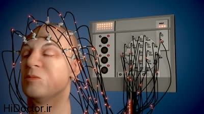 electroencephalograph (5)