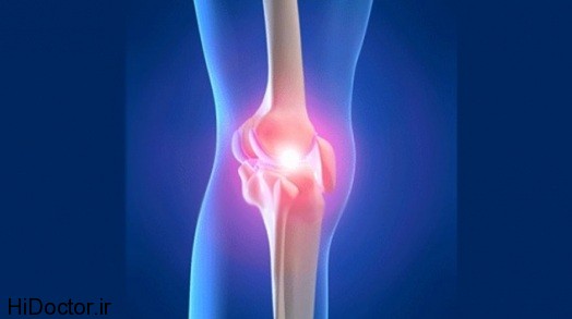 knee-cartilage injury