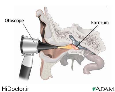 http://www.hidoctor.ir/wp-content/uploads/2015/05/otoscope-3.jpg