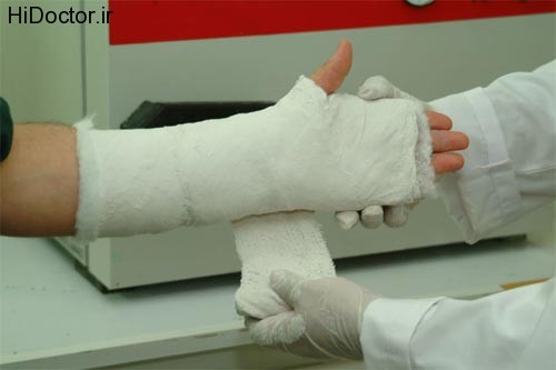plaster bandages (12)
