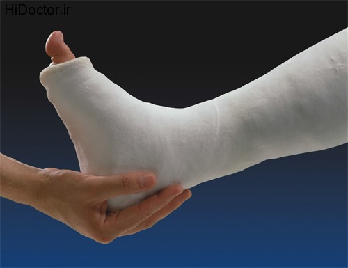 plaster bandages (4)