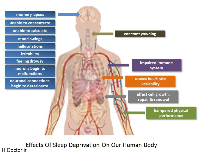 sleep-deprivation-on-human-body