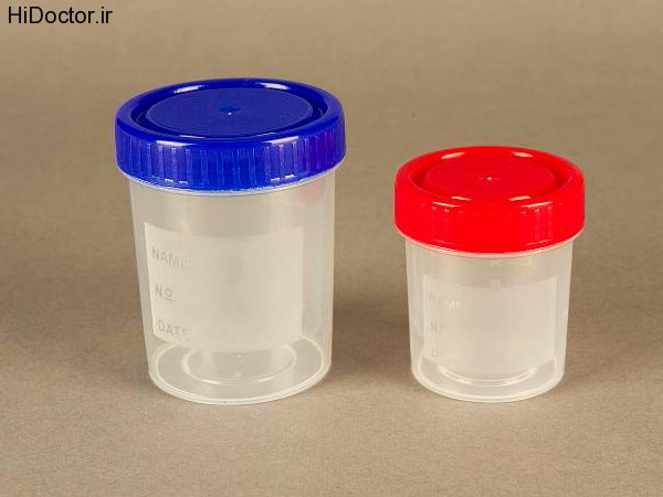Sterile sample containers (1)