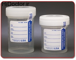 Sterile sample containers (11)